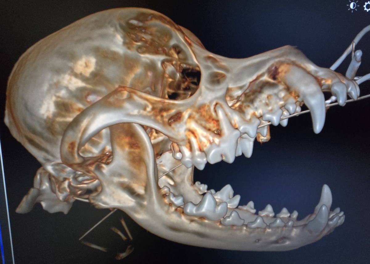 CT Scan