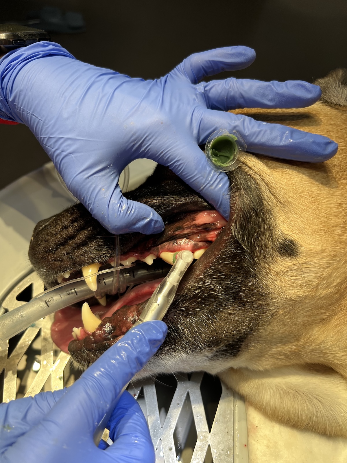 Teeth polishing 