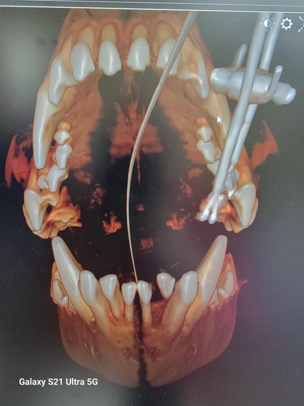 dental rad